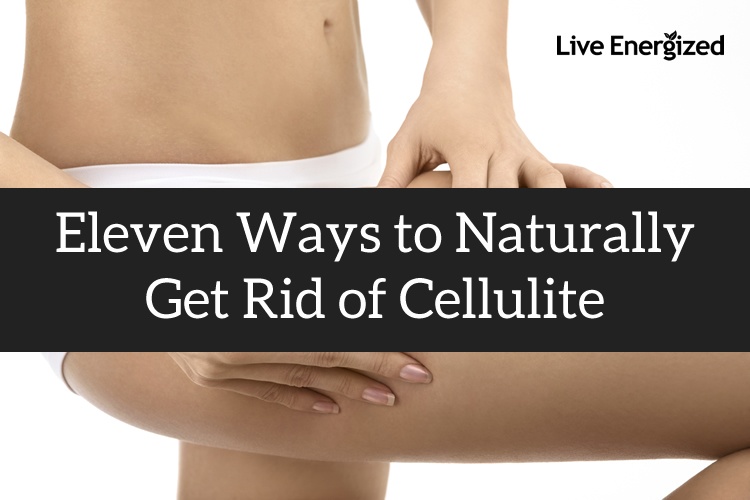 Excitement About 6 Science-backed Tips To Naturally Reduce Cellulite thumbnail